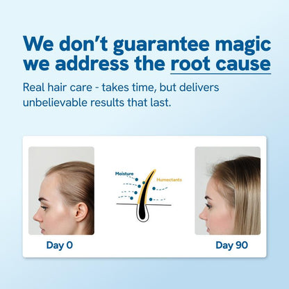 Hair Growth Roller - Scalp Regrowth Device - Hair Thinning Treatment